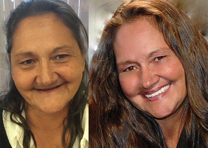 Allday Secure Gebislime