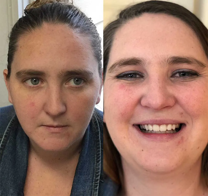 Allday Secure Gebislime