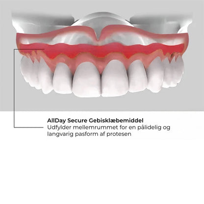 Allday Secure Gebislime